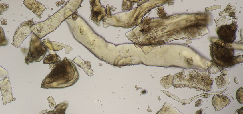 Fish muscles muscles of fish - Processed animal protein in feed